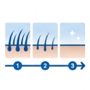 icono-IPL-luz-pulsada-resultados-progresivos